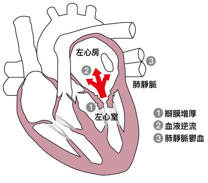 犬黏液性二尖瓣疾病 MMVD-楊崇君 獸醫師