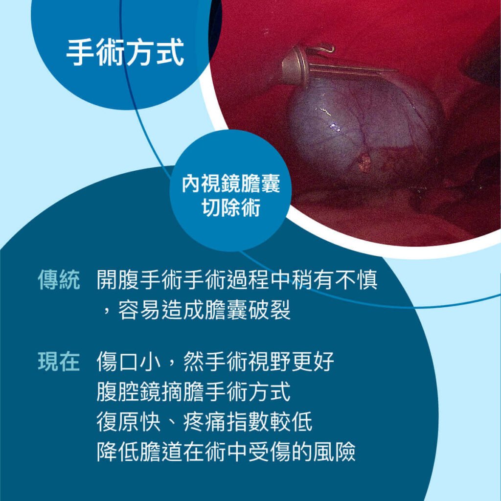 狗膽囊黏液囊腫-衛教與案例分享 外科部 施品丞/蔡佩倫 獸醫師