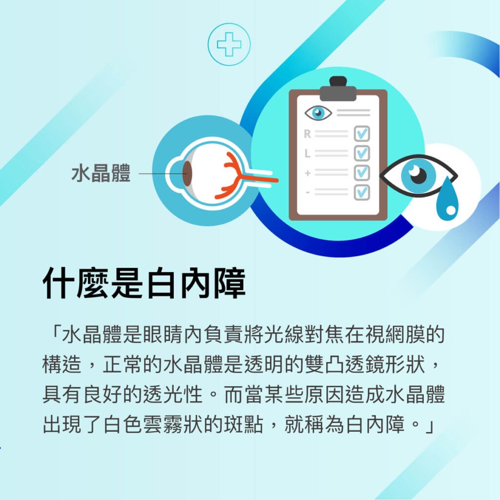 王郁盈醫師-白內障眼科特別門診
