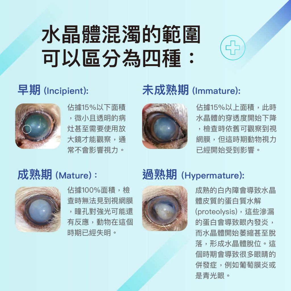 王郁盈醫師-白內障眼科特別門診
