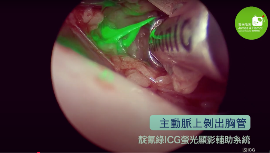 Step1：進行胸腔鏡胸管結紮術
